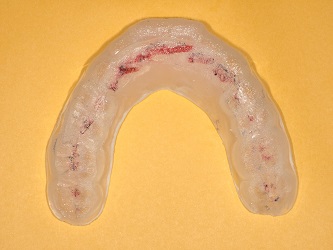 スプリント（ナイトガード）